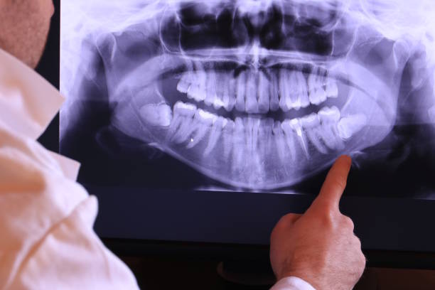Best Emergency Dental Services for Seniors in Shelburne Falls, MA